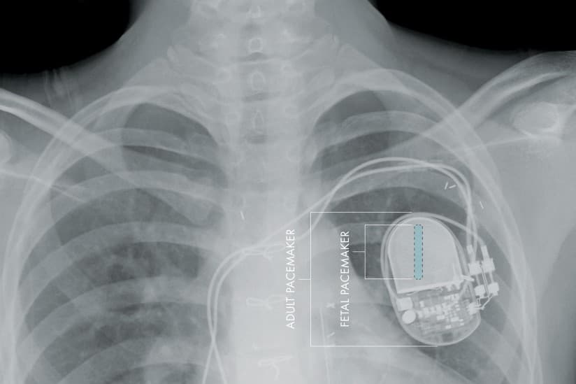 Data breaches in the healthcare sector are fueling the dark web
