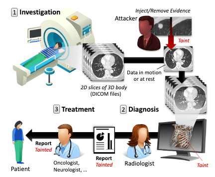 Hackers can add, remove cancer and other illnesses from Computer Tomography scans
