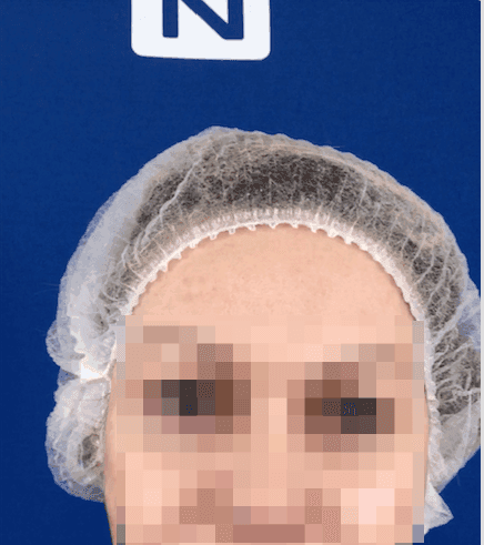 NextMotion plastic surgery tech firm data leak
