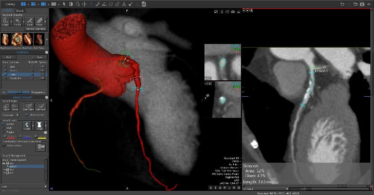Reflected XSS Canon Medical